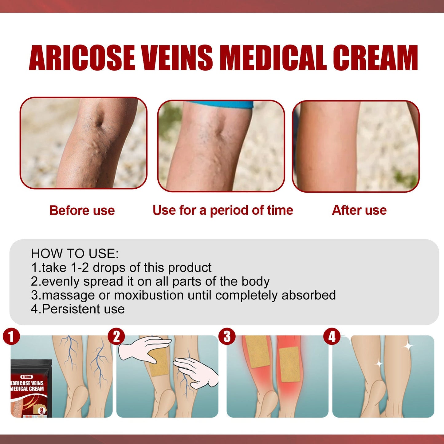 Aricose Veins Medical Cream, Relieve Leg Swelling Earthworm Leg Vein Massage To Relieve Pain