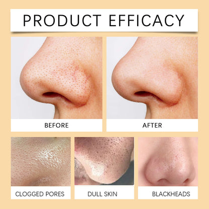 Enzymes Exfoliating Brightening Gel, Gentle Exfoliating Cleansing Gel Deeply Purifies Pores, Removes Blackheads And Brightens Skin