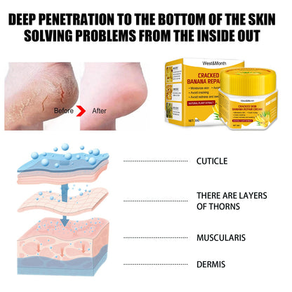 Cracked Skin Banana Repair Cream, Nourishing And Moisturizing Foot Repair Cream To Soften Exfoliation And Remove Dead Skin Calluses