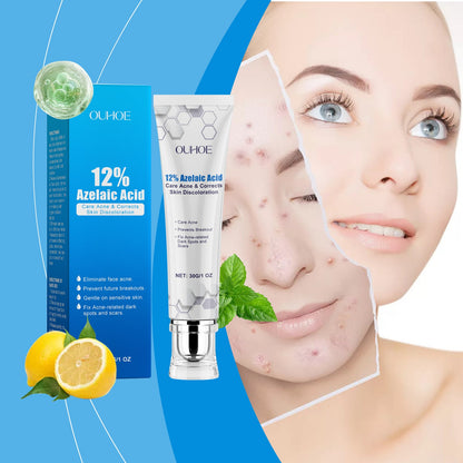 Azelaic Acid Acne Cream Gently Nourishes And Moisturizes Skin And Balances Oil And AcneOuhoe Azelaic Acid Acne Cream Gently Nourishes And Moisturizes Skin And Balances Oil And Acne
