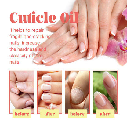 Cuticle Oil, Repair Dry Rotted Nails Thickening Moisturizing Care Brightening Nails And Cleaning