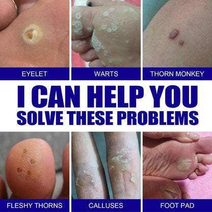Wart Remover Ointment, Remove Hou Warts Flat Corn Plaster Flat Grains Warts, Foot And Repair Skin Dot Mole G Wart Cream