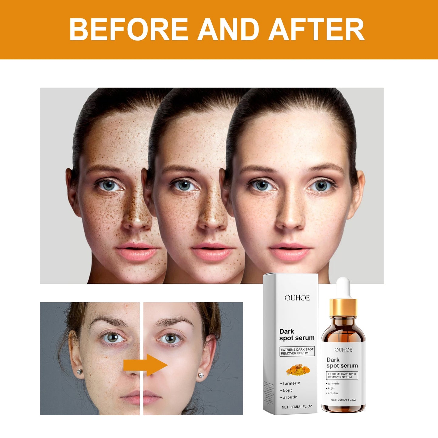 Dark Spot Serum, Hydrating Moist Firming Facial Skin Repair Skin Dark Bright Skin Care Essence