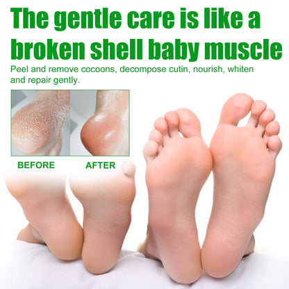 Aloe Vera Foot Mask, Moisturizing Anti-Cracking, Dead Skin Removal, Tender Skin Care Foot Mask
