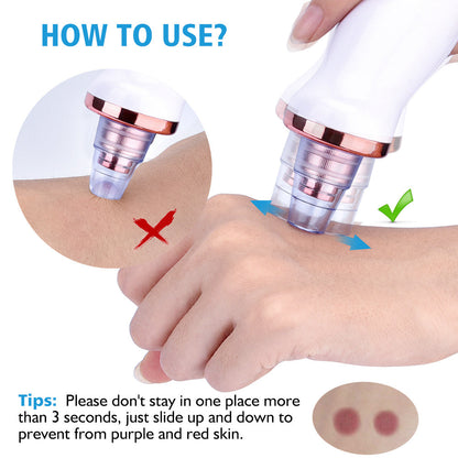 Electric Blackhead Suction Facial Washing Instrument