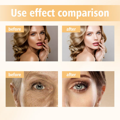 Skin Brightening Serum, Moisturizing And Lightening Spot Melanin Repair Dark And Whitening Skin Essence