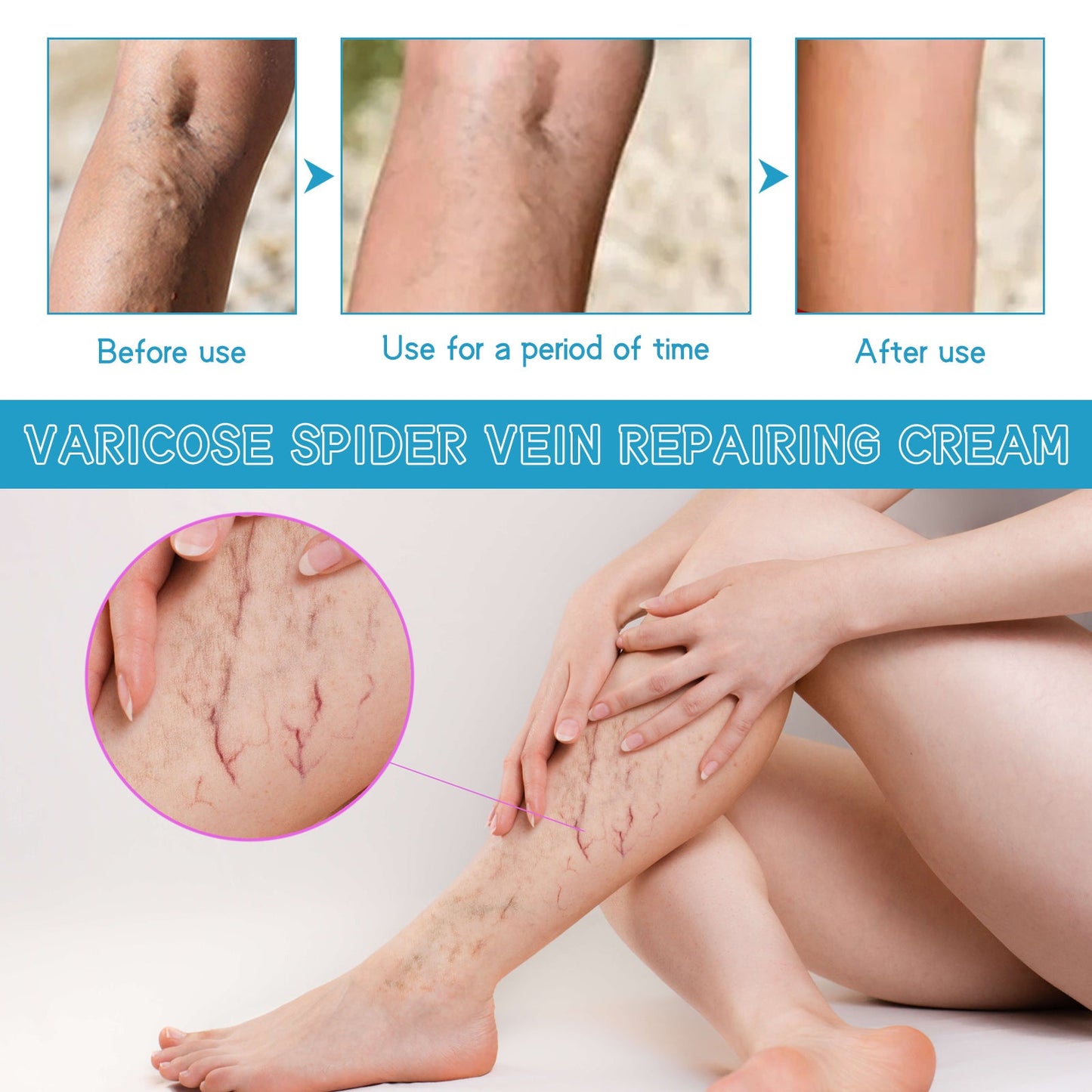 Varicose Spider Vein Repairing Cream, Relief Leg Pain Earthworm Leg Veins Care Massage Cream