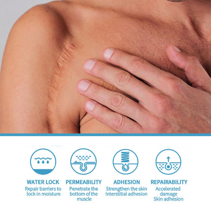 Scar Repair Serum Lightens Post-Pregnancy Scar Repair And Smoothes Body Skin