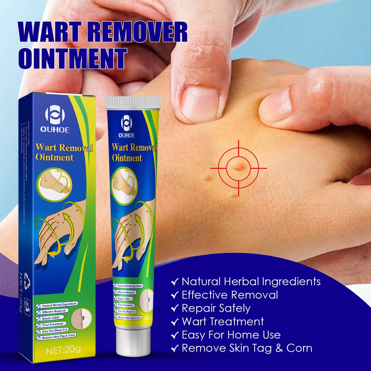 Wart Remover Ointment, Remove Hou Warts Flat Corn Plaster Flat Grains Warts, Foot And Repair Skin Dot Mole G Wart Cream