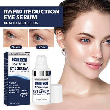 Eye Repair Essence Moisturizes, Hydrates And Lightened Eye Lines, Strengthens, Lifts And Smooths Fine Lines