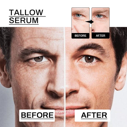 Anti-Wrinkle Serum For Men, Anti-Wrinkle Firming Skin Young Elastic Moisturizing Translucent Essence