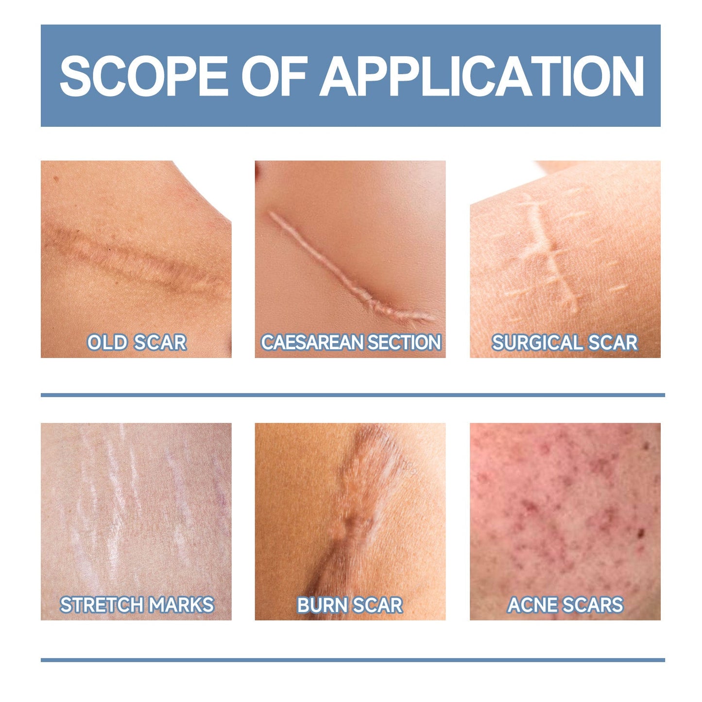 Oceaura Scar Whitening Repair Gel Moisturizes And Smooths Skin Repair Surgery Scar Pregnancy Care Gel