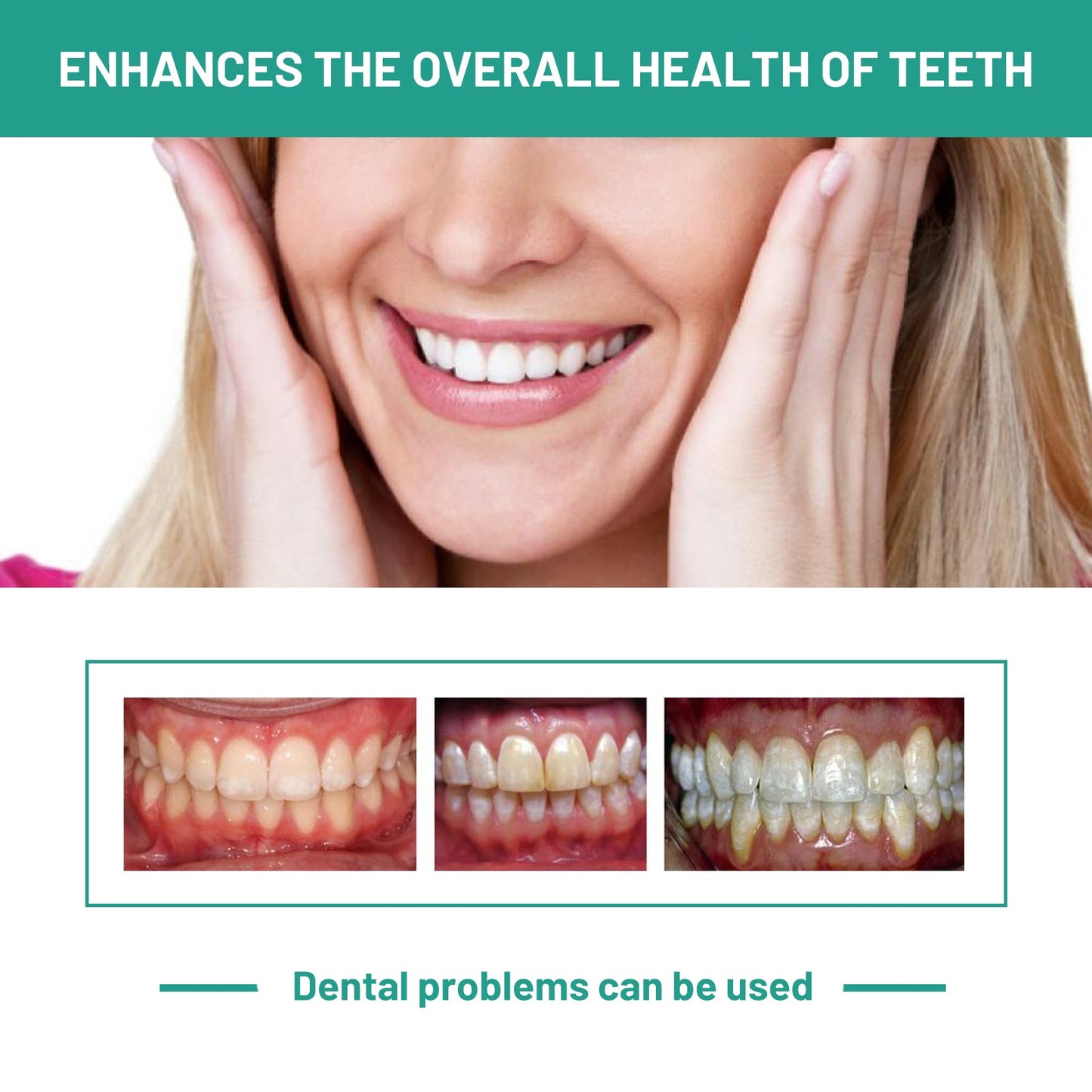 Probiotics Bright Whitening Teeth Mousse, Clean Mouth Odor Tartar Very Well To Protect The Gum Beautiful White Teeth
