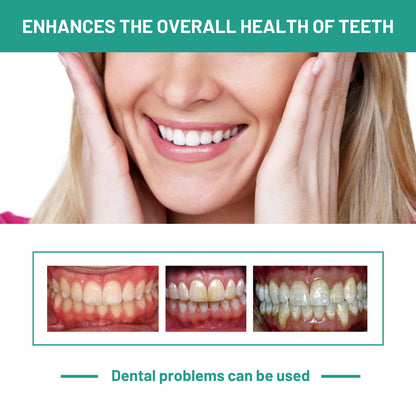 Probiotics Bright Whitening Teeth Mousse, Clean Mouth Odor Tartar Very Well To Protect The Gum Beautiful White Teeth