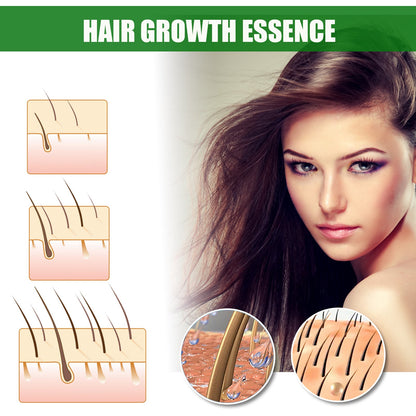 Ginger Hair Growth Spray, Nourishing And Nourishing Hair Root, Hair Care Solution To Prevent Scalp Loss