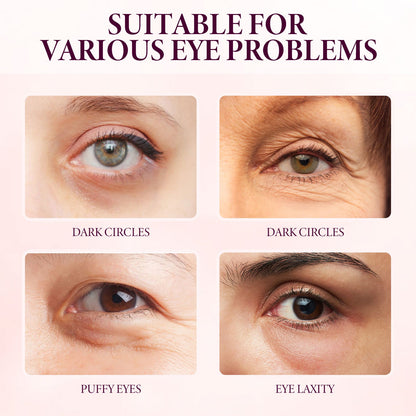 Mango Eye Cream Reduces Fine Lines Of Crow's Feet Bags And Gently Nourishes Elasticity And Tightens The Skin Around Eyes