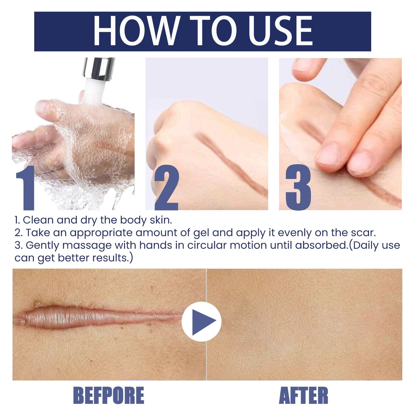 Scar Gel, Fade Skin Scar Pregnancy Surgery Scar Moisturizing Skin Care Gel