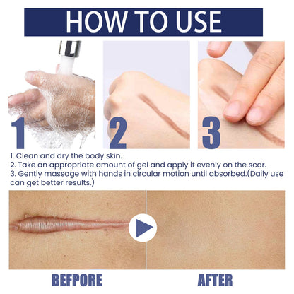 Scar Gel, Fade Skin Scar Pregnancy Surgery Scar Moisturizing Skin Care Gel