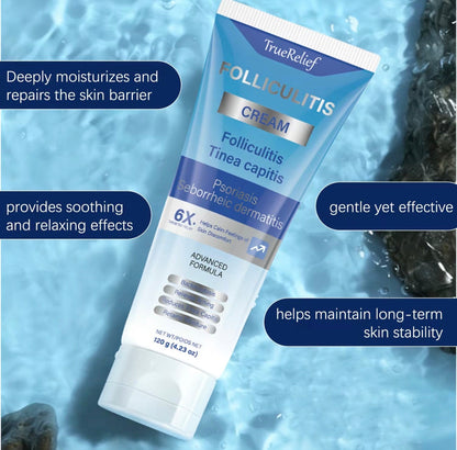 Follicalm Soothing Skin Cream