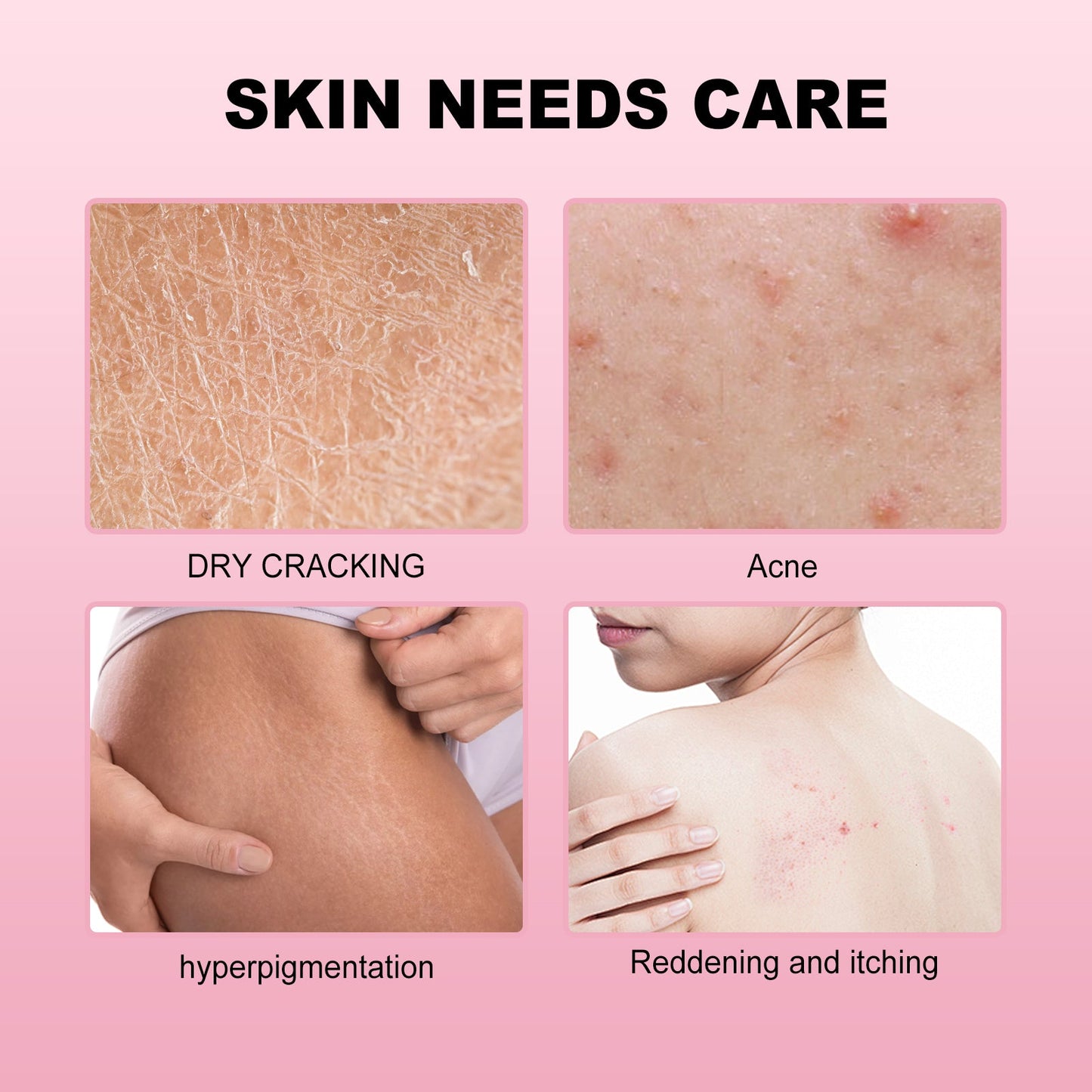 Strawberry Body Care Oil Moisturizes Tender And Firming Skin Full Body Massage Body Care