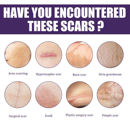 Silicone Scar Patch, Reduces Stretch Marks And Hyperplasia Of Caesarean Section Scars Silicone Patch