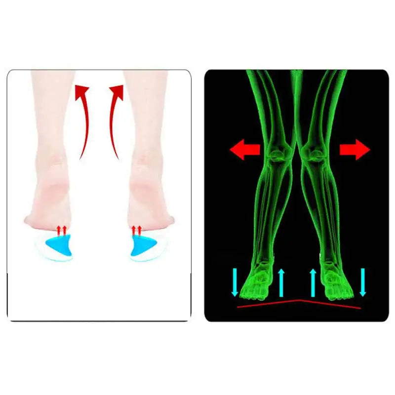 2Pc Arch Support Insole Of Flatfoot Gel Pads For Feet Orthotics Insoles Foot Health Care Massage Muscle Resist Painful Massager