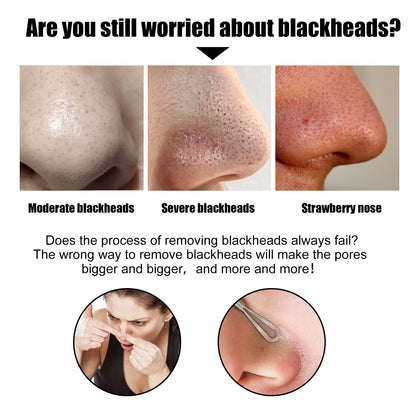 Black Pig Nose Patch, Bamboo Charcoal Remove Blackhead Acne Tear Nose Mask Patch
