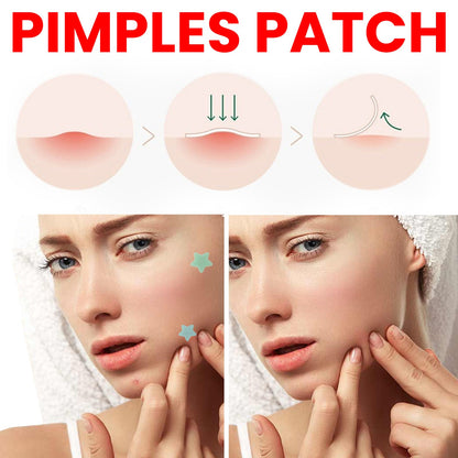 Pimples Patch, Repair Pockmarks Lighten Pimples Blemishes Cover Pimples