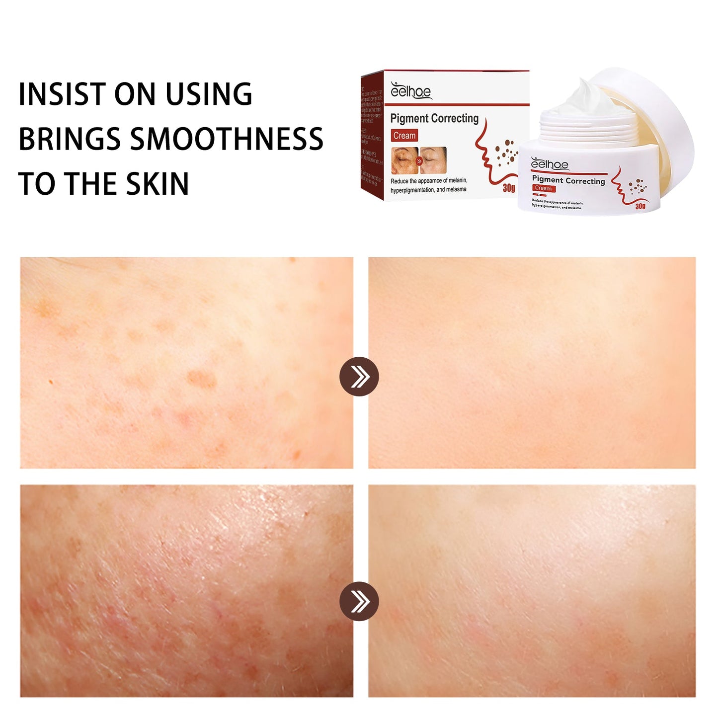 Pigment Repair Cream, Moisturizing And Lightening Freckles Dark Spots Spots Melasma Melanin Beauty Cream