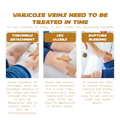 Vein Renewal Smooth Legs Cream, Relief Sore Legs Massage Varicose Earthworm Leg Vein Care Cream