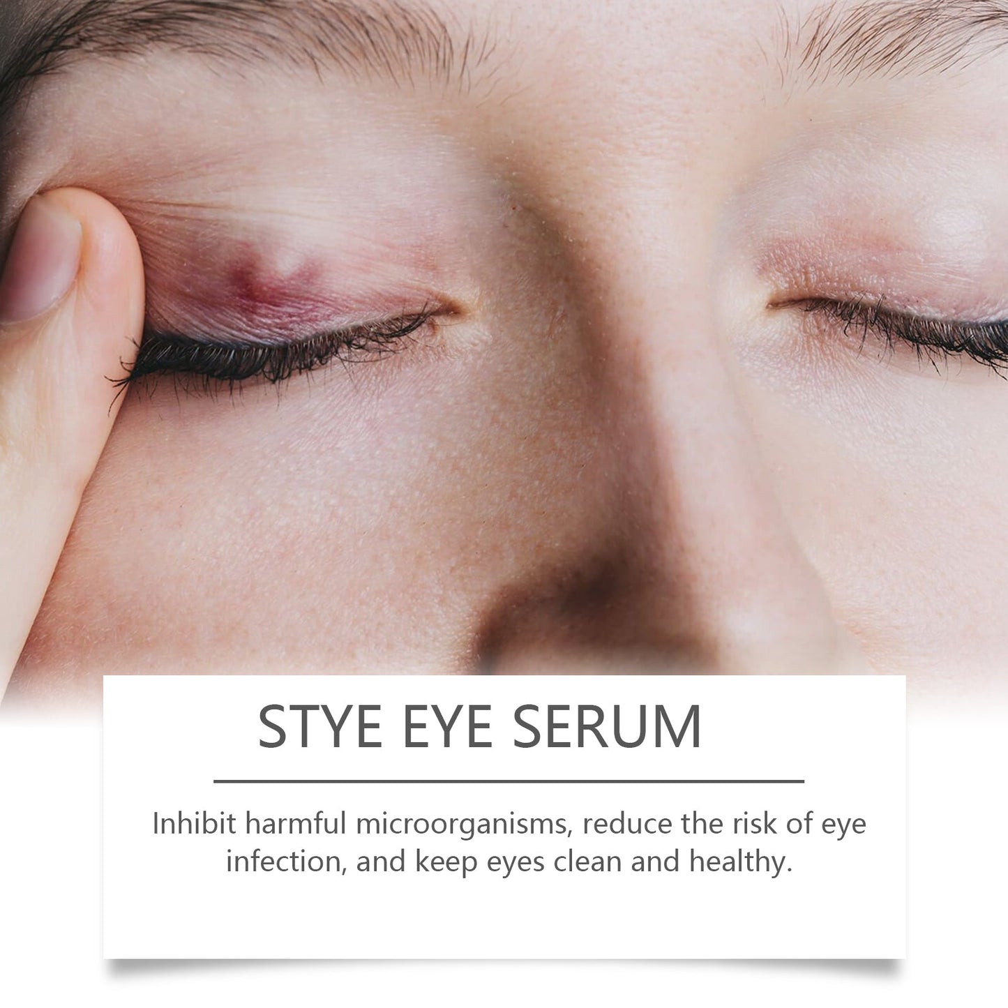 Eye Care Solution, A Gentle Moisturizing Eye Solution That Relieves Acidness, Is A Daily Portable Eye Care Drops