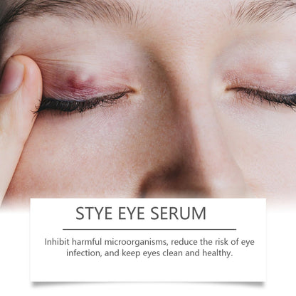 Eye Care Solution, A Gentle Moisturizing Eye Solution That Relieves Acidness, Is A Daily Portable Eye Care Drops