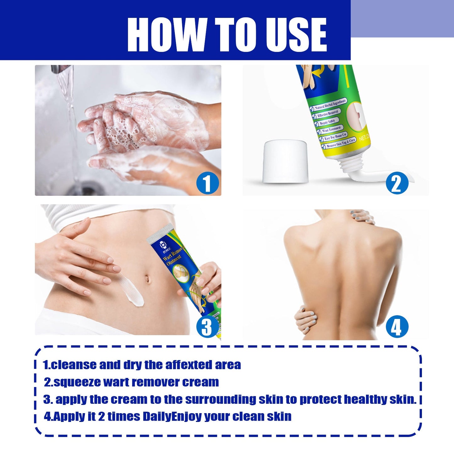 Wart Remover Ointment, Remove Hou Warts Flat Corn Plaster Flat Grains Warts, Foot And Repair Skin Dot Mole G Wart Cream