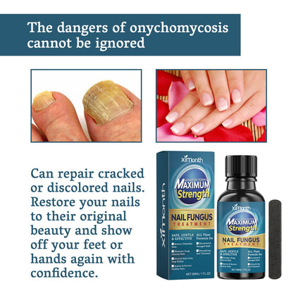 Nail Fungus Treatment, Nail Thickening Of Embedded Light Mail This Soft Armour Brothers Nails Detailer