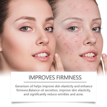 Retinol Essence Oil, Repair Facial Acne Skin Nourishing Elastic Hydrating Moisturizing Skin Care Essence
