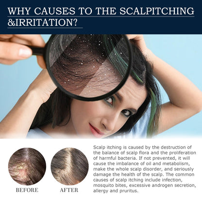 Scalp Treatment Essence Spray, Hair Care And Repair Damaged Hair Follicle Hair Root Treatment Spray