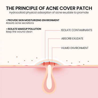 Pimples Patch, Mild Non-Irritant Lightening Pimples Spot Pimples Mark Covering Acne Pimples Patch