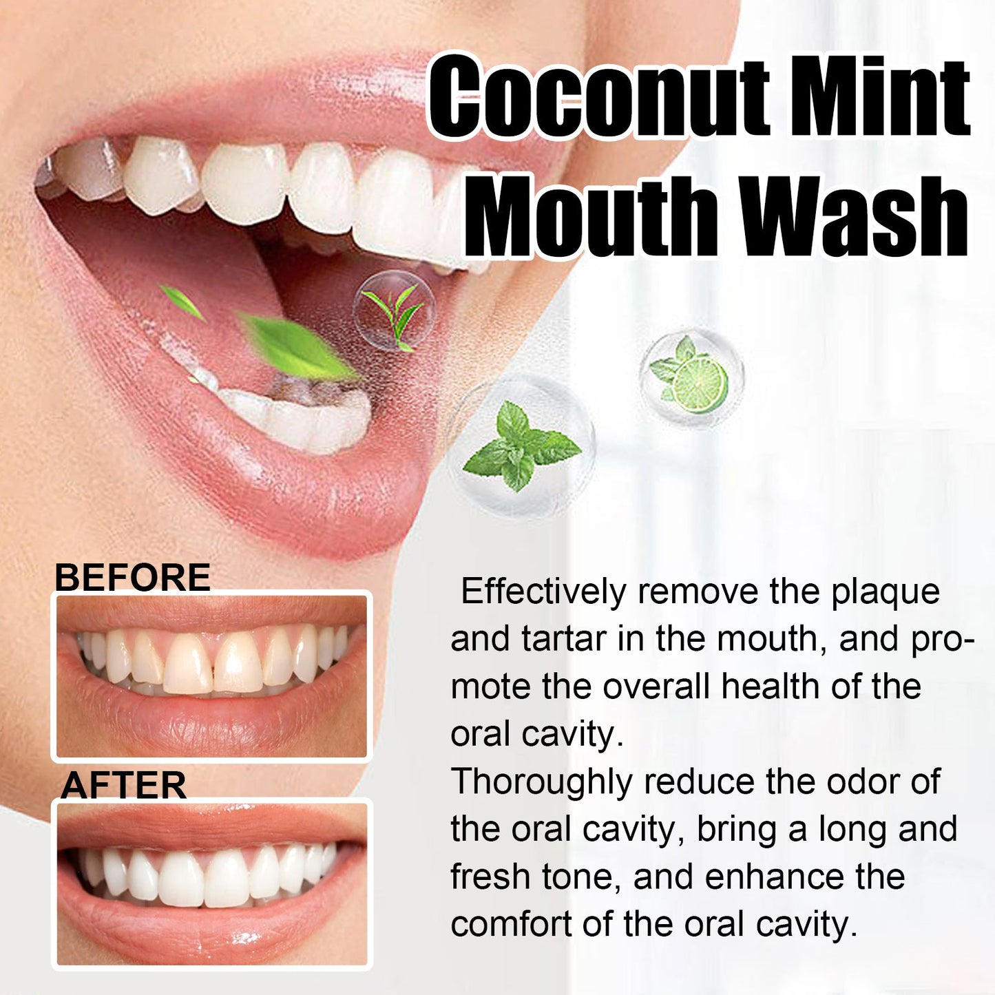 Teeth Rinse, Deep Clean Mouth Fresh, Deodorizing And Whitening Teeth Stain Removing Mouthwash