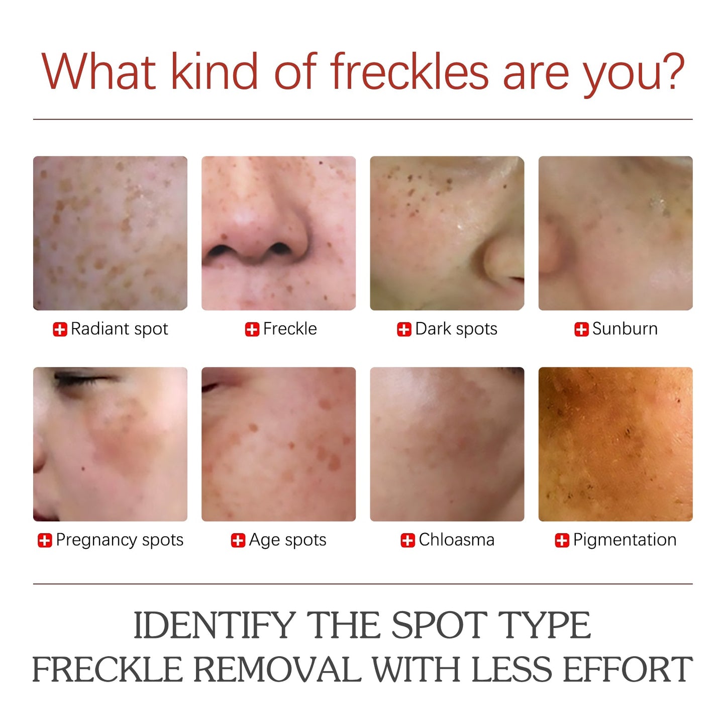 Pigment Repair Cream, Moisturizing And Lightening Freckles Dark Spots Spots Melasma Melanin Beauty Cream