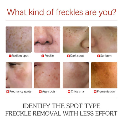 Pigment Repair Cream, Moisturizing And Lightening Freckles Dark Spots Spots Melasma Melanin Beauty Cream