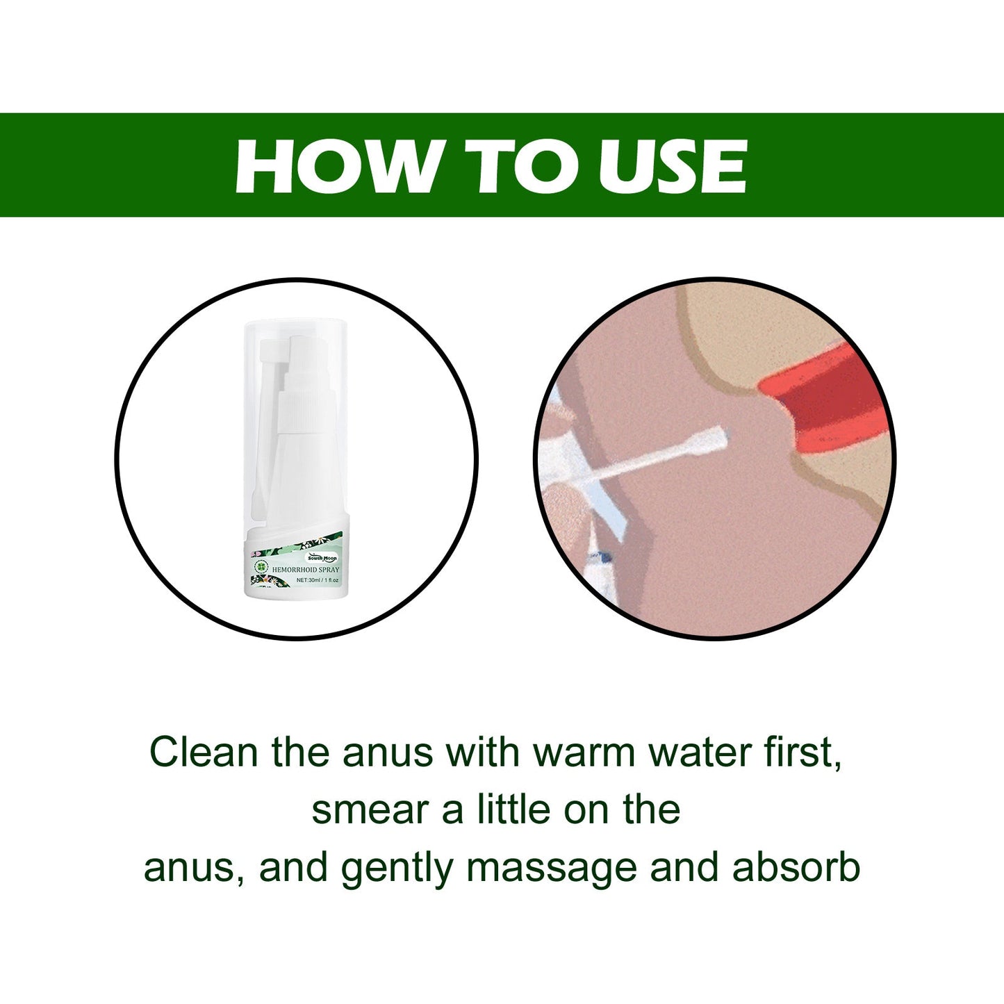 Hemorrhoids Spray, Relieve Swelling And Hemorrhoid Pain External Treatment For Broken Sore Anal Soothing Spray
