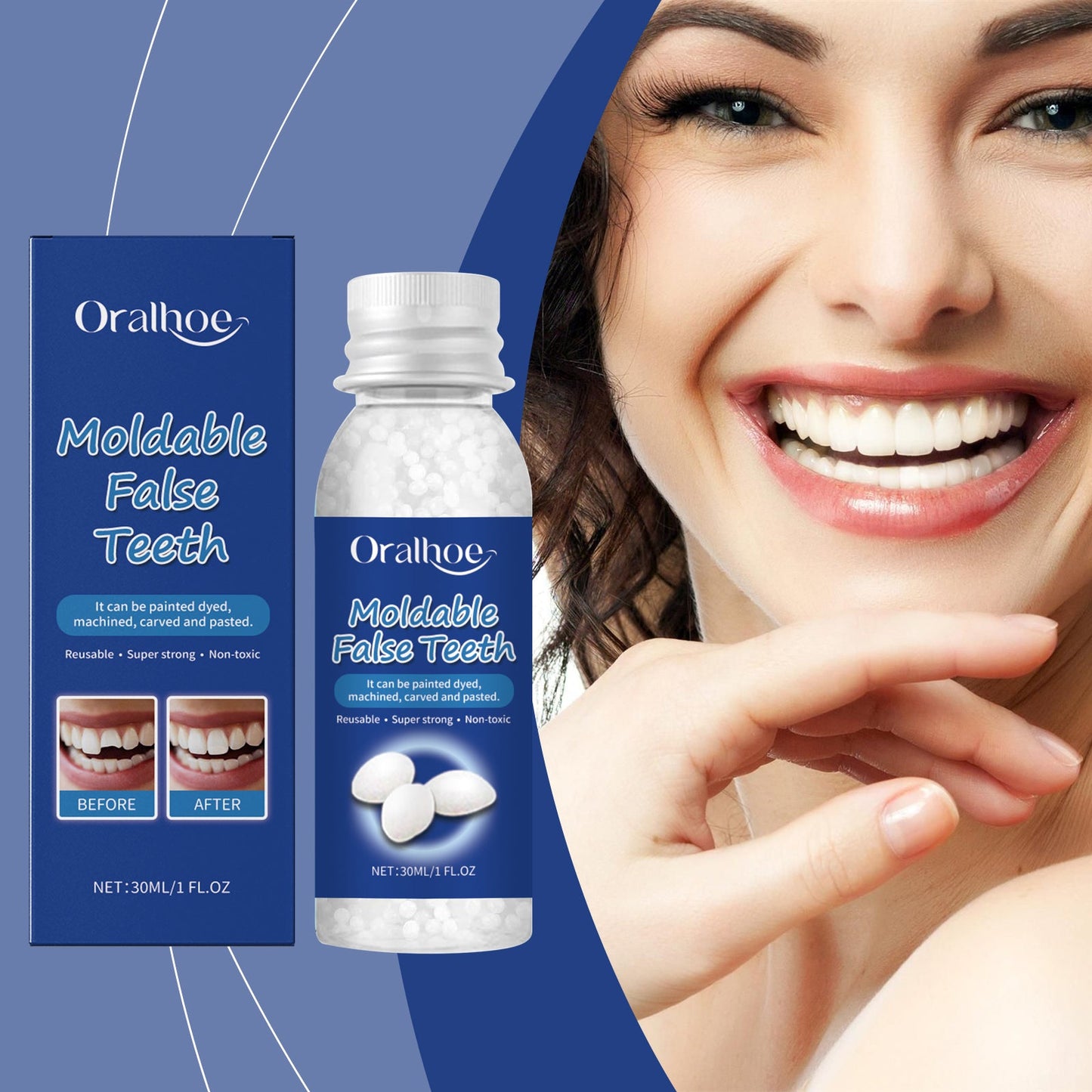 Solid Dental Glue, Temporary Dental Fillings For Modified Teeth And Dentures For Dentures