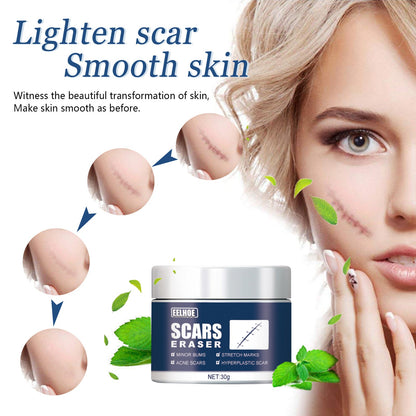 Scar Balm, Surgery Scar Repair Cold Compress Scar Skin Scar Gel Balm