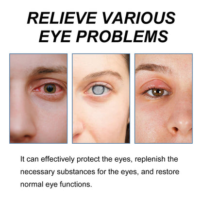 Myopic Eye Drops For Eye Fatigue, Swelling, Swelling, Blurred Vision Mild Eye Drops