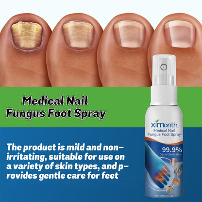 Medical Nail Fungus Foot Spray, Repair Thickening Gray Nail Rot Foot Moisturizing And Cleansing Armor