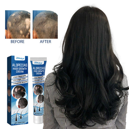 Alopecias Hair Growth Cream, Protect Hair Follicles Strong Moisturizing Thick Hairline Hair