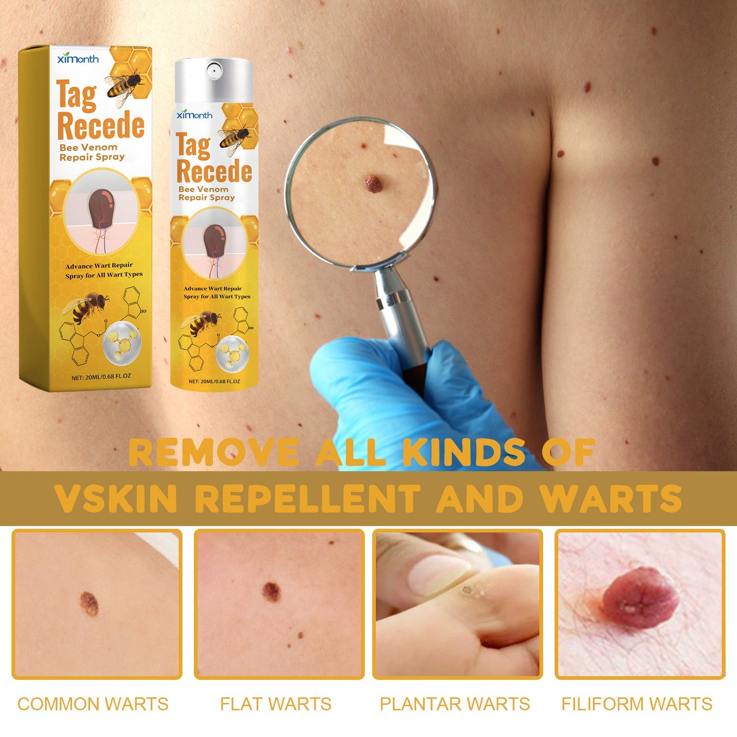 Bee Venom Wart Treatment Spray Improves Pimples, Moles, Repairs and Smooths Skin Wart Treatment Spray