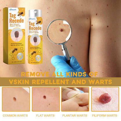 Bee Venom Wart Treatment Spray Improves Pimples, Moles, Repairs and Smooths Skin Wart Treatment Spray