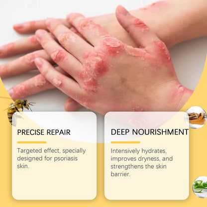 Skin Care Cream Moisturizing Herbal Cool Soothing Moisturizing Anti-Dandruff Moisturizing Gentle Skin Care