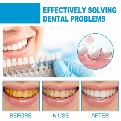 Mouth Mousse Toothpaste Teeth Clean Teeth Remove Tartar Stains Yellow Teeth Whitening Teeth Fresh Breath